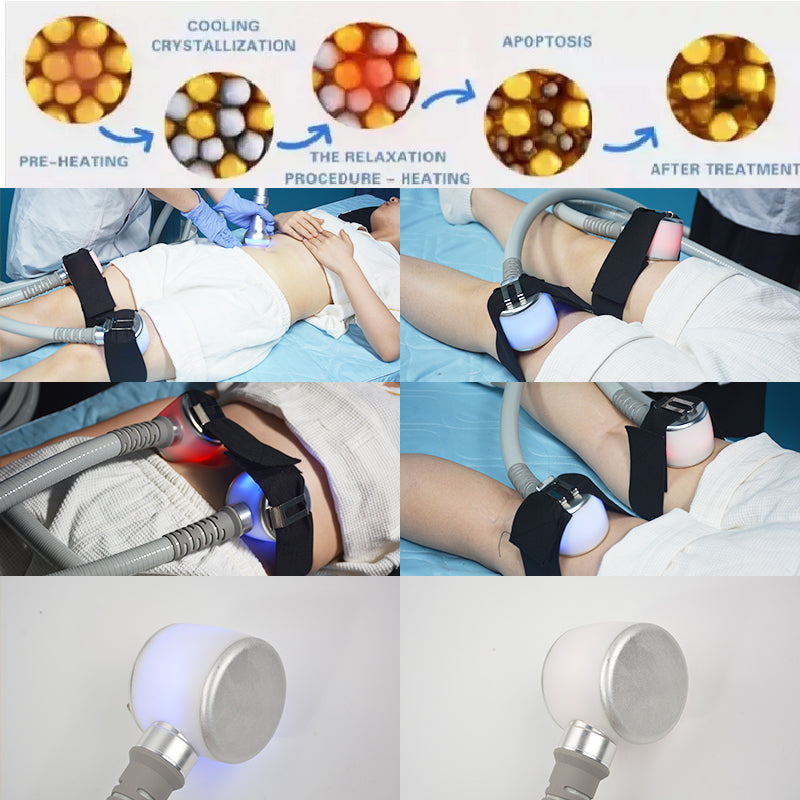 Cryoskin C10 Cryo Thermal Shock Body Sculpting Machine with 4 Pads safe fat reduction & skin firming