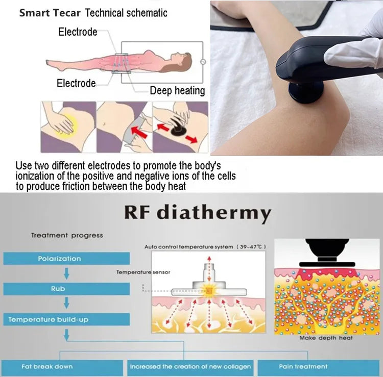 Smart Tecar CET RET Radiofrequency Diathermy Machine — Pain Relief, Physiotherapy & Body Care | NEWBELLE